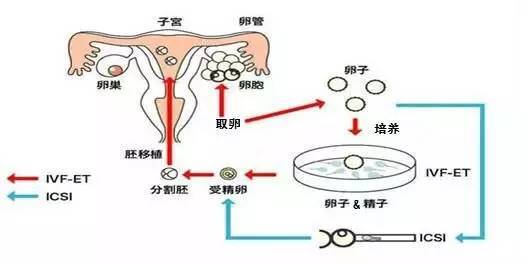 产后恢复师刘凯的产后恢复理论与实践